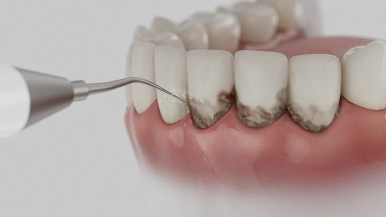 Trusted Tooth Extraction service in Arden Hills, MN - Dentist Open Now